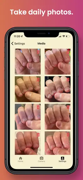 Game screenshot NailKeeper - Stop Biting Nails hack